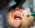 brokn tooth repair albuquerque